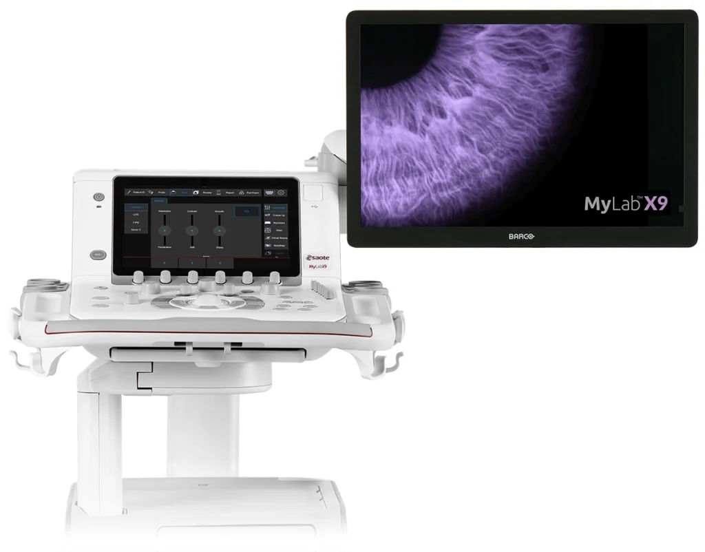 csm mylatmx9 0bcc2b159f (1)