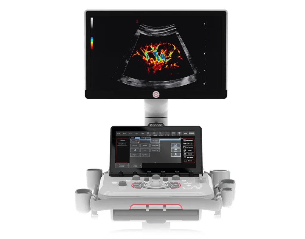 csm esaote mylab a50 hero 51f125c5af (1)